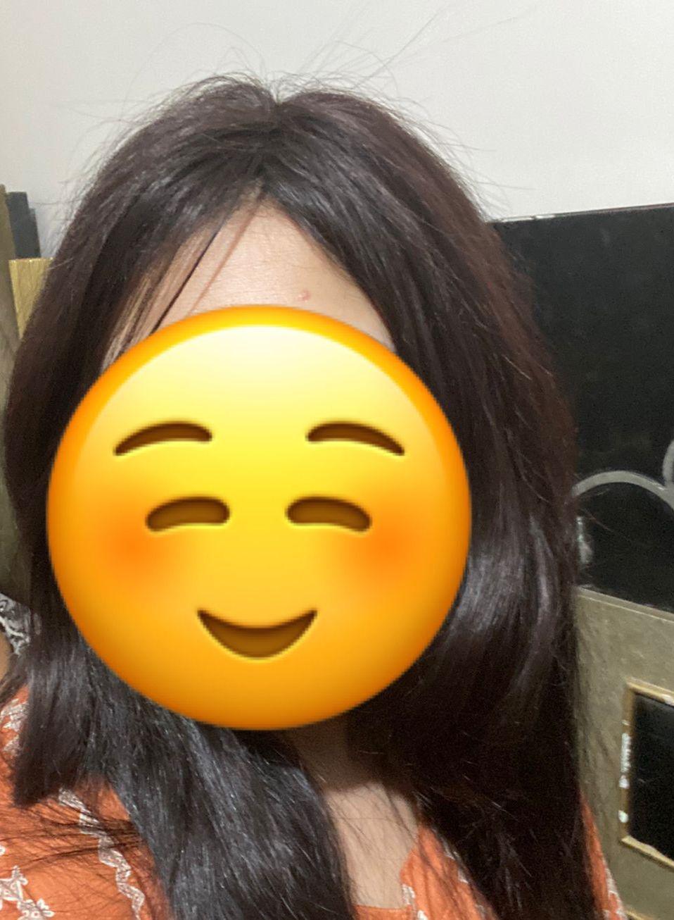 Smart Topper - World Hair Extension